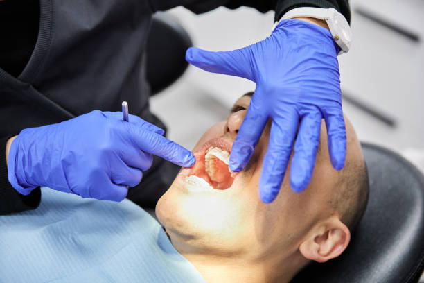 Best Same-Day Emergency Dentist in Fort Dodge, IA