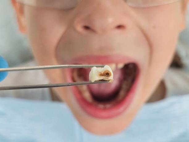 Best Emergency Dental Care for Trauma or Injury in Fort Dodge, IA