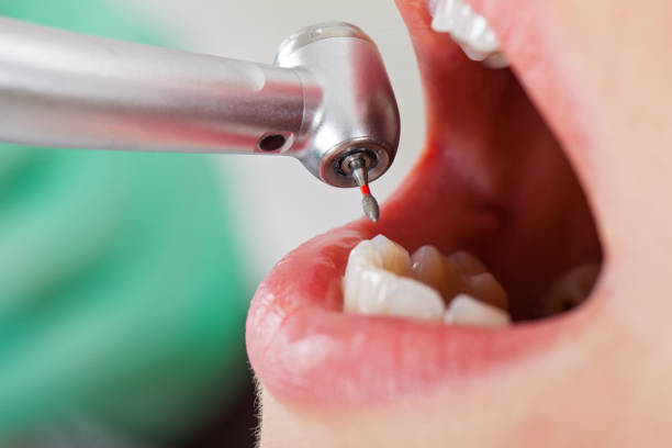 Best Pediatric Emergency Dentist in Fort Dodge, IA